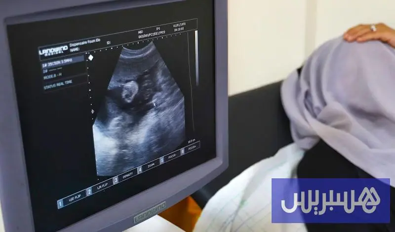 دراسة تكشف استمرار النشاط البيولوجي للمبايض بعد انقطاع الطمث