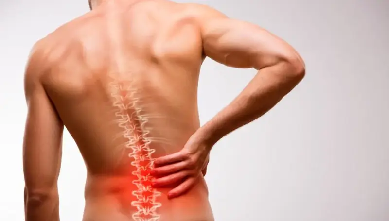 متى يصبح التدخل الجراحي ضرورياً لعلاج الديسك في الظهر؟