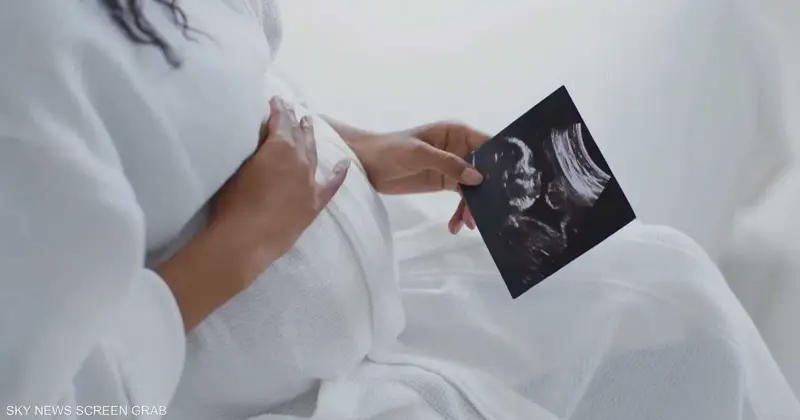 أدوية حديثة للصداع النصفي ترتبط بزيادة خطر الإجهاض