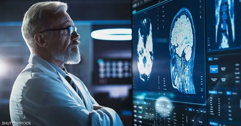 الدماغ وألم الظهر.. علاقة معقدة تكشفها دراسة جديدة