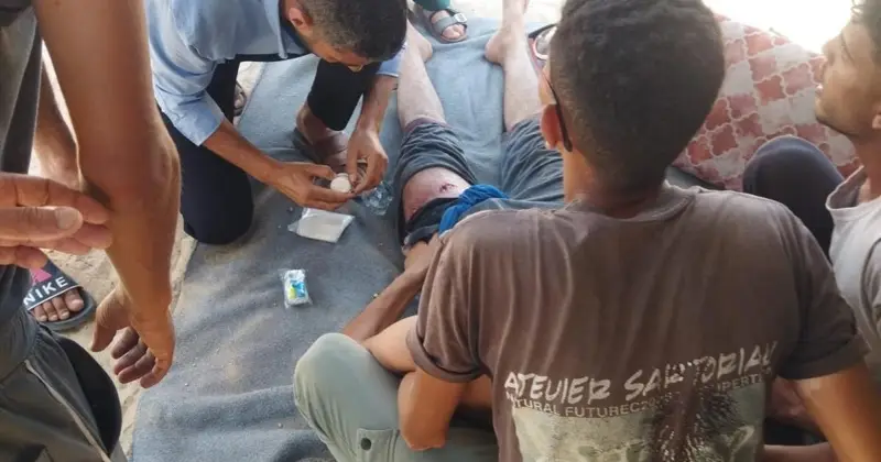 إصابة مواطن برصاص الاحتلال وإطلاق نار يستهدف منازل وخيام نازحين في غزة