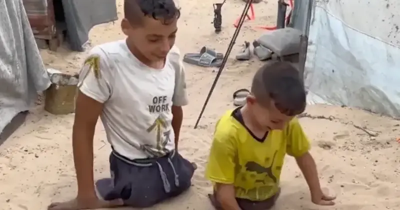 10 آلاف طفل فقدوا ساقاً على الأقل خلال 3 أعوام من إبادة غزة