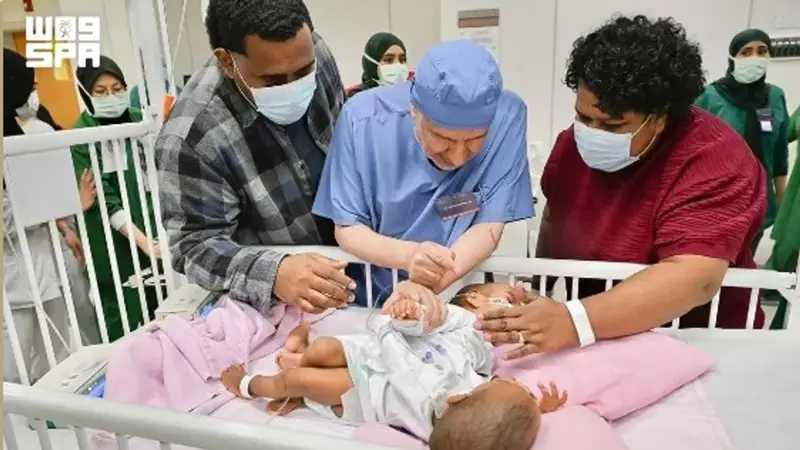 الربيعة يعلن بدء مرحلة الفصل الأساسية للتوأم السيامي الفيجي
